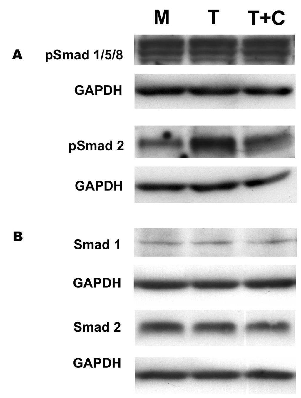 CHAPTER 7 FIGURE 3 C Fig. 3. Influence of L-carnosine on ALK signaling. A: representative Western blot of psmad1/5/8 and psmad2.