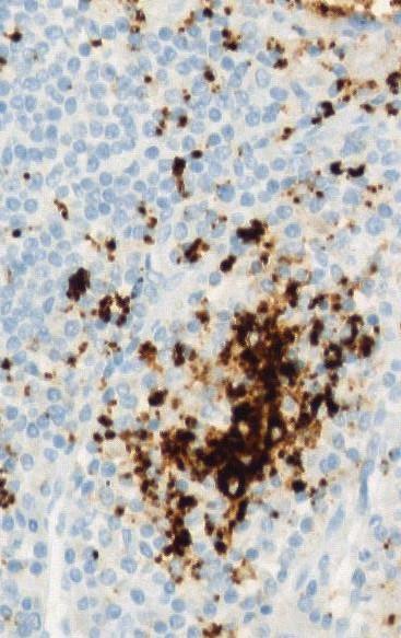 Cells (IC) SP142* Immune cells Fehrenbacher L et