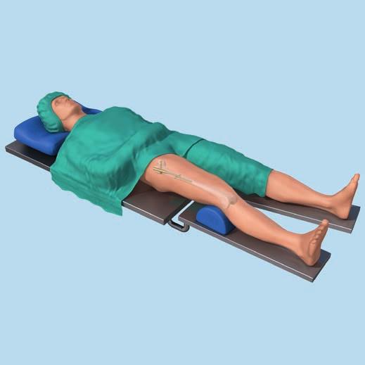 PATIENT POSITIONING 1 Position patient Position the patient supine on an extension table or a radiolucent operating table.