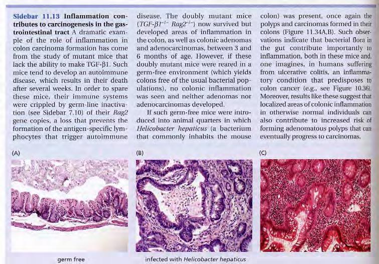 disease - intestinal and colon cancer