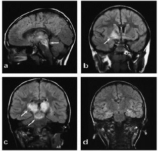 inposterior hypothalamus and rostral brainstem.