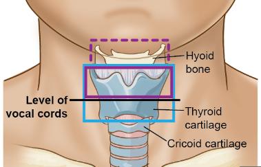 Cricoid Cartilage N3 - below the caudal border of the cricoid cartilage Clinical & Pathological RLN Categories HPV-Mediated OPC (Ch 10) N Clinical N Criteria Pathological N Criteria NX RLN cannot be