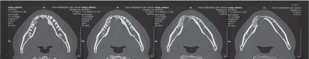 tomography (CT) White