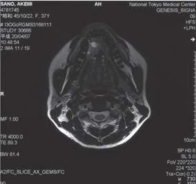 Resonance Imaging (MRI) T1
