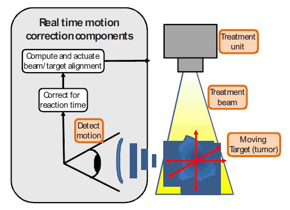 Motion tracking Some basics Continuous adjustment of radiation beam or patient position to follow the changing position of the target or its surrogate A means of localizing the target in real-time is