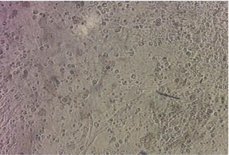 Fig 3.16: Few rounded cells CPE of first isolated virus on Chicken embryo fibroblast cell culture after Seven days post infection with isolated IBV Virus (3 rd passage). (200X) Fig 3.