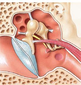 Communicates with nasopharynx via auditory eustachian tube Permits equalization of pressures on either side of tympanic membrane Contains 3 ossicles Malleus (hammer) Incus