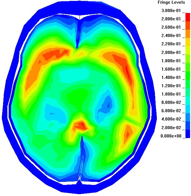 Strain pattern in the brain CT images