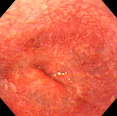 respectively. b Close-up image around the esophagogastric junction.