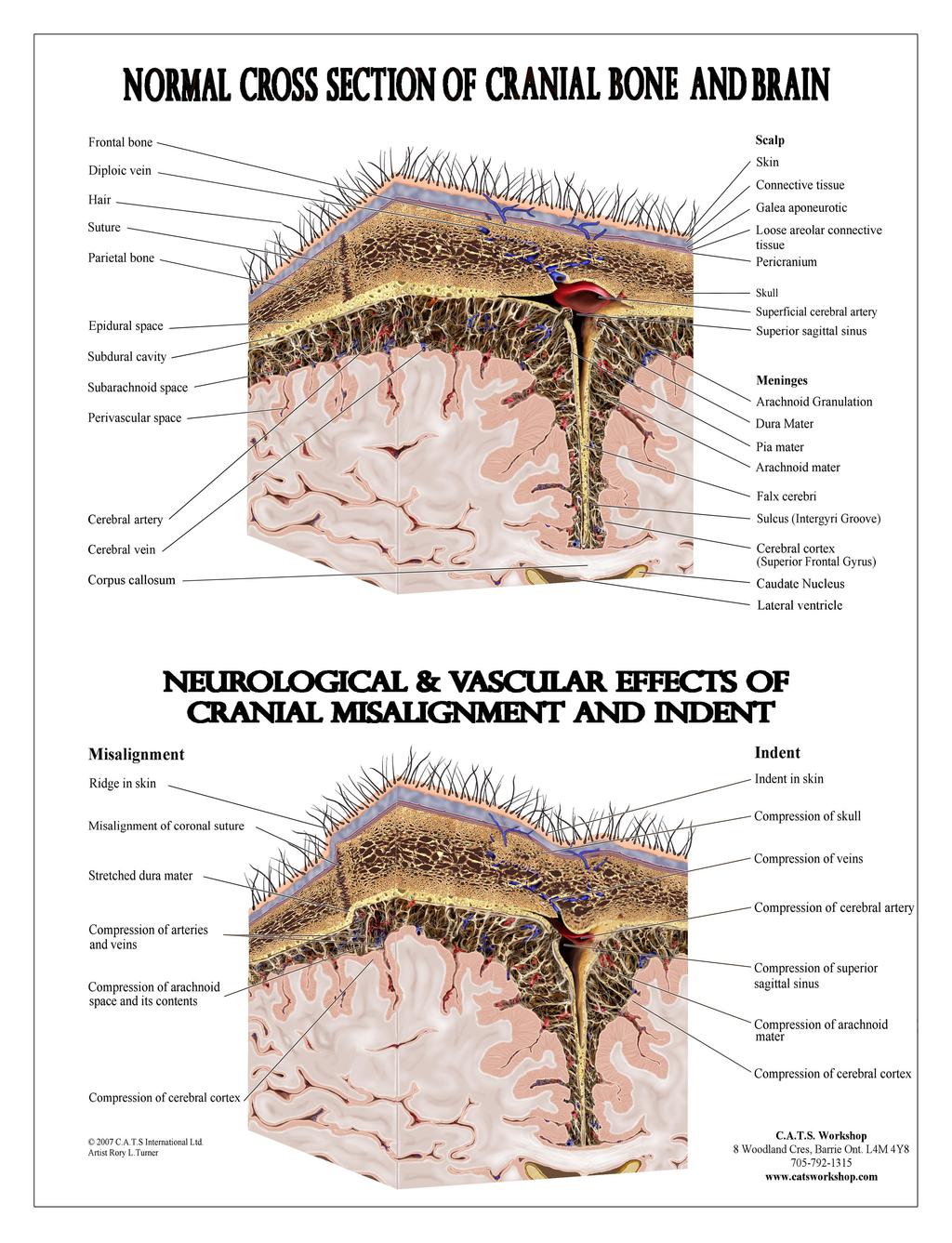 Fig. 1. Cross Section of the Brain, Top diagram: this is the normal view of the cross section of the brain.