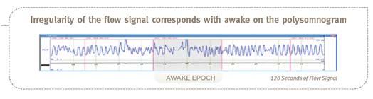 breathing pattern during relaxed sleep