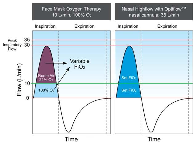 Mechanisms of Action: Accuracy With Nasal High Flow we aim to meet the patient s inspiratory demand with flow This