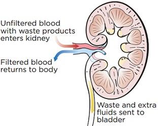 Kidney failure can occur suddenly (acute) or over a period of years (chronic).