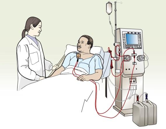 Figure 3. A patient receiving dialysis Getting dialysis at MSK Before you start dialysis If you are admitted to MSK as an inpatient, you can get dialysis here.