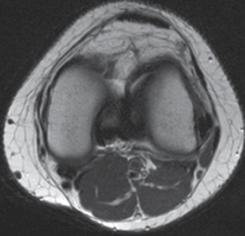 Sagittal PD-W MR image. Fig. 4.
