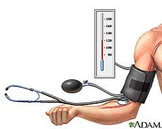B is for Blood Pressure What is the impact of blood