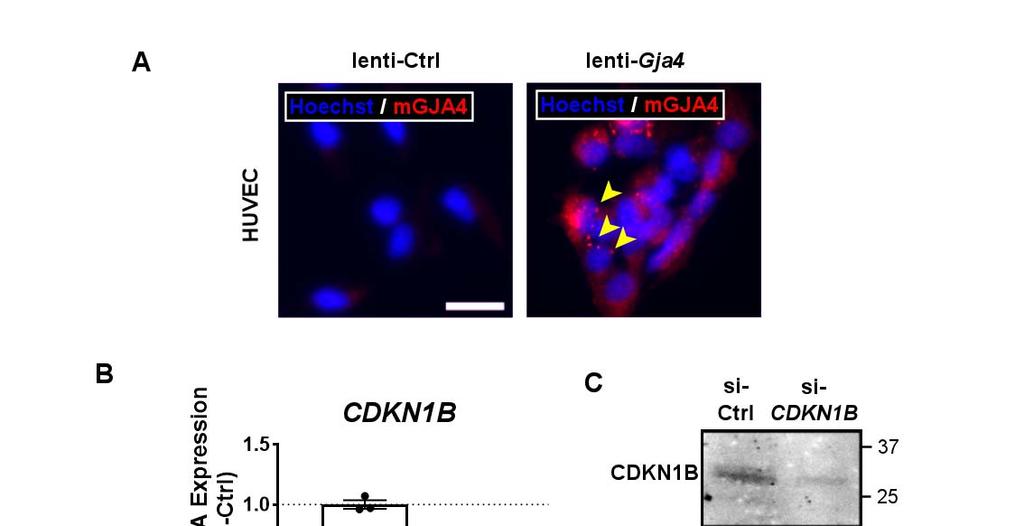 Supplementary Figure 12: Validation of tools used to manipulate GJ4 and CDKN1B expression.