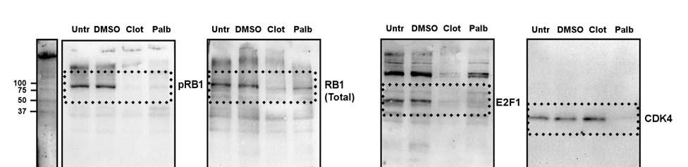 Supplementary Figure 16: Uncropped western blots for Figure 7.