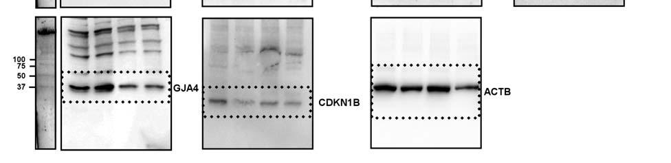 RB1, and E2F1 indicating induction of G1 arrest. In addition, palbociclib eliminates CDK4 expression.