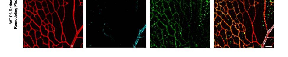 where smooth muscle actin (SMA)-invested arteries were detected.