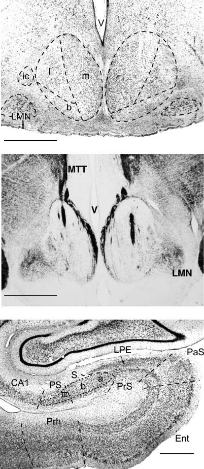 Hippocampal projections to mammillary bodies 2521 33-lm coronal sections on a freezing microtome. The sections were then mounted from phosphate buffer.