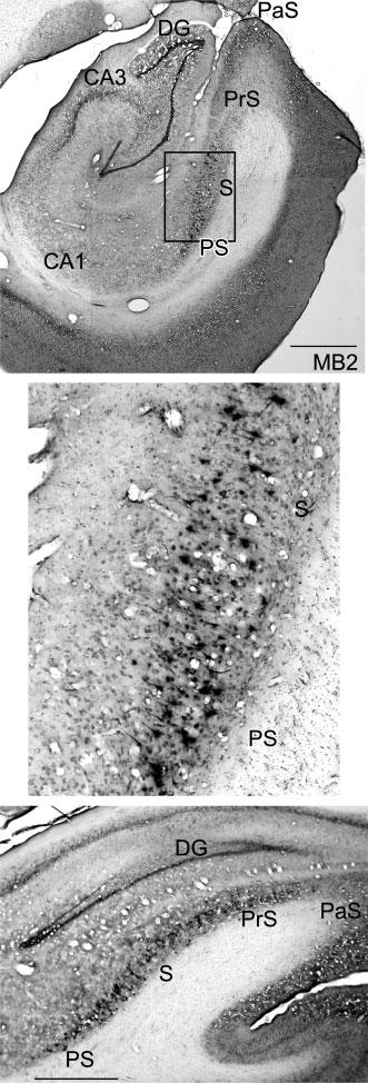 Photomicrographs of HRP-positive cells in the mid (Upper) and caudal (Lower) levels of the hippocampus following an injection of HRP in case MB2.