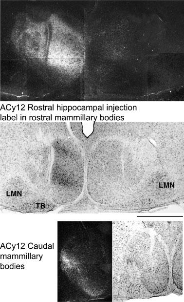 Hippocampal projections to mammillary bodies 2525 Fig. 7. Distribution of anterograde label in the mammillary bodies after an injection involving the rostral subiculum (case ACy12).