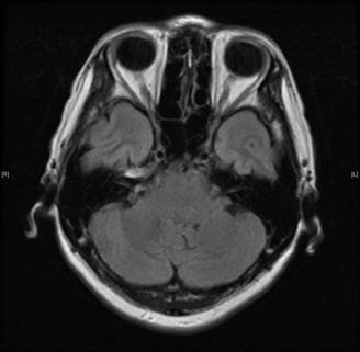 Cranial MRI