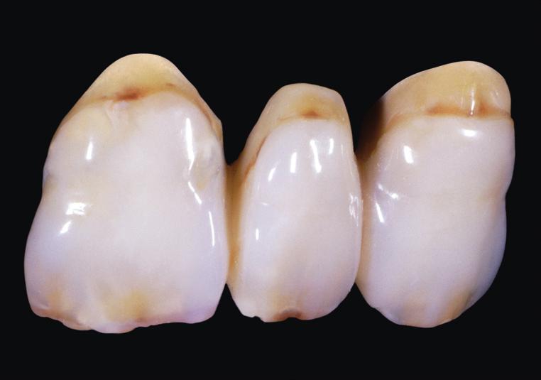 Particularly impressive are the results obtained by combining and Genios denture teeth.