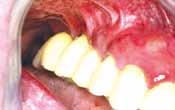 Clinical Cases Implantology,