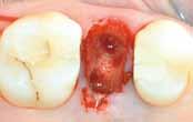 Clinical Cases Implantology,
