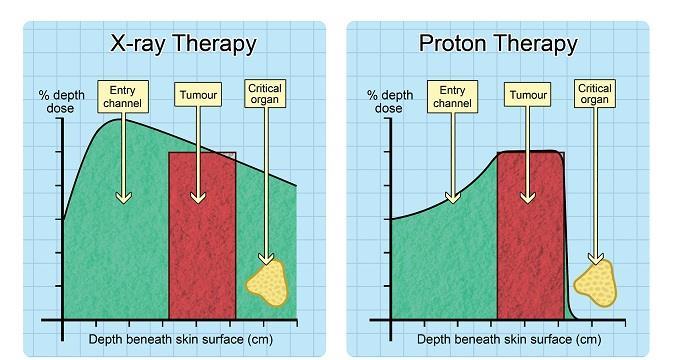 Proton Beam Therapy Radiation Therapy Photons Exponential behaviour Protons Low entrance Dose (plateau)