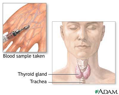 Thyroid Function Test (TFT) Test that