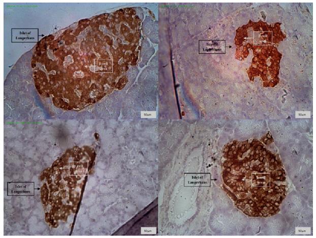 158 WAHYUNI ET AL. Jurnal Ilmu Kefarmasian Indonesia Picture 3. Overview of the pancreatic β-cells. Clockwe, P 0 with 74.38% area; P 1 with 23.04%; P 3 with 62.10%; P 2 with 49.16%. IHC, 400x.