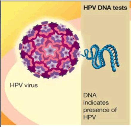 HPV Human Papilloma Virus HPV is a DNA Virus. Its infection is a cause of nearly all cases of cervical cancer.