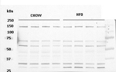 Autophagy is Decreased in DIO Mice p62 LC3 Chow HFD 14