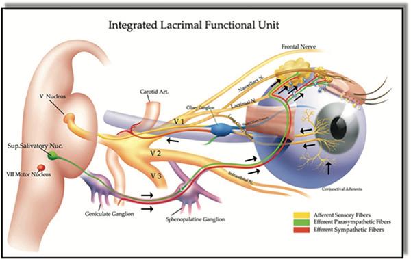 Pathophysiology Multifactorial condition resulting in a dysfunctional lacrimal functional unit leading to a vicious cycle of inflammation on the ocular surface Dysfunction/disease of tear secretory