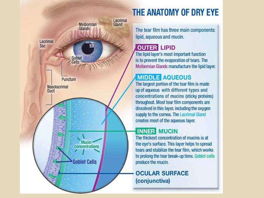 Subtypes of Dry Eye Evaporative (most common) Aqueous deficiency Mucin deficiency Exposure
