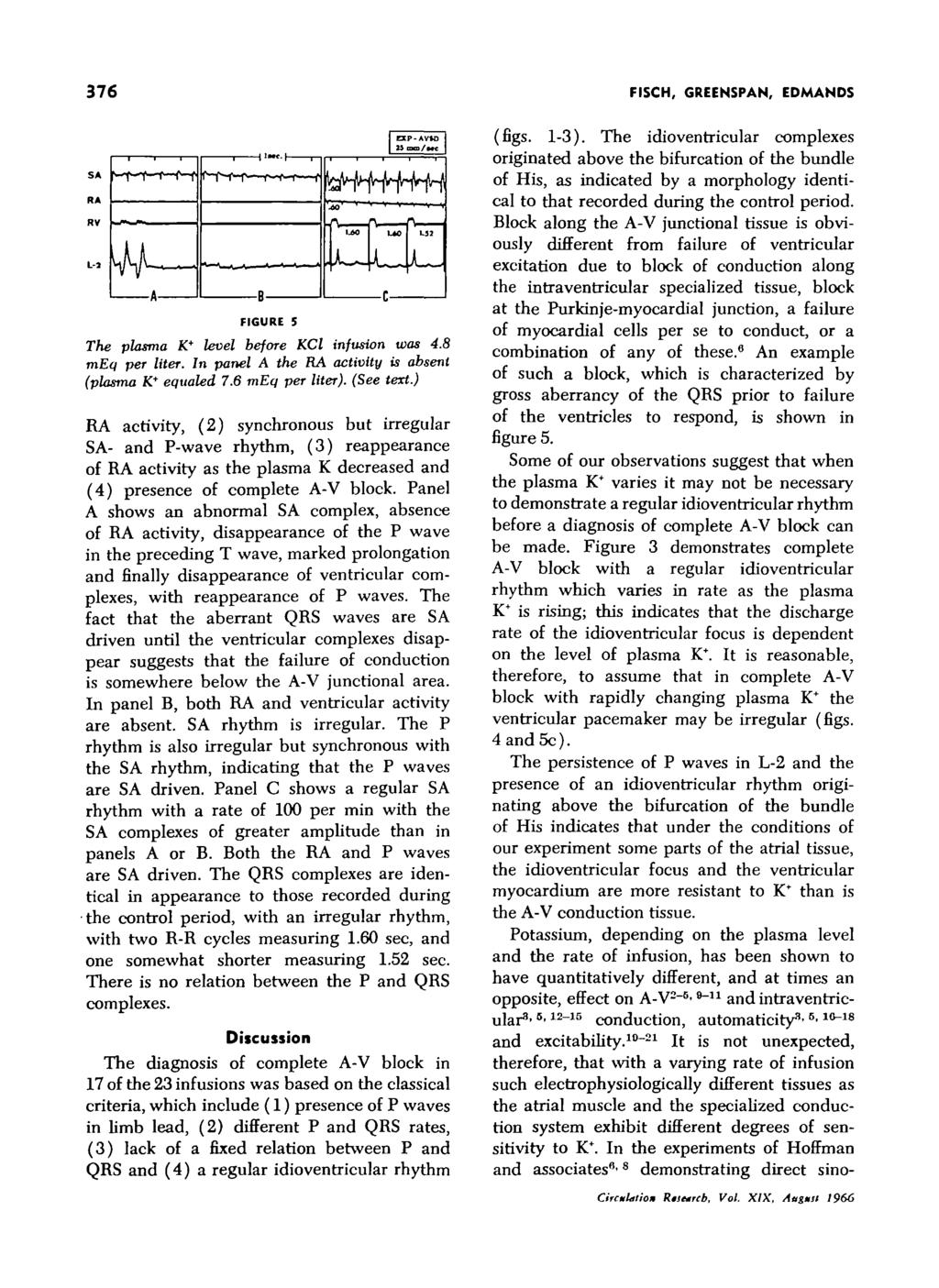 376 FISCH, GREENSPAN, EDMANDS FIGURE 5 The plasma K* level before KCl infusion was 4.8 meq per liter. In panel A the RA activity is absent (plasma K* equaled 7.6 meq per liter). (See text.