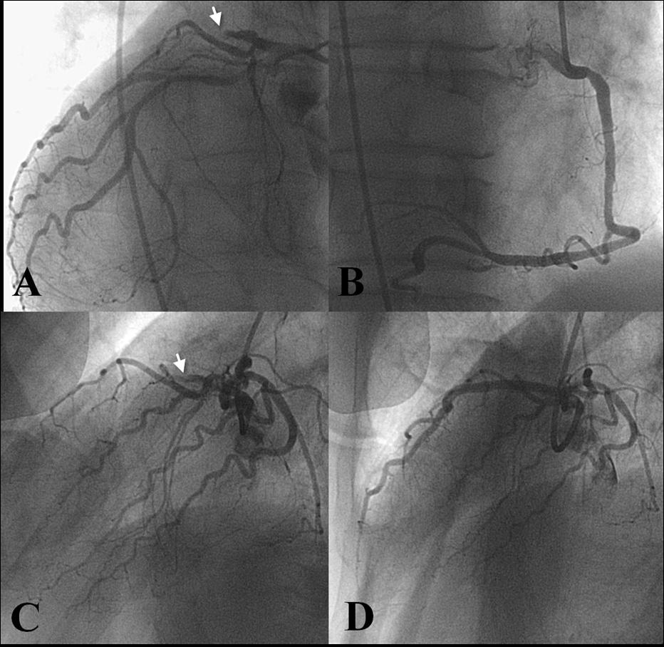 (Ao=aorta; LA=left atrium; LV=left ventricle; RV=right ventricle; VS=ventricular septum). Fig. 4.