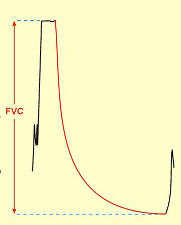 FVC - forced expiratory vital capacity The volume change of the lung