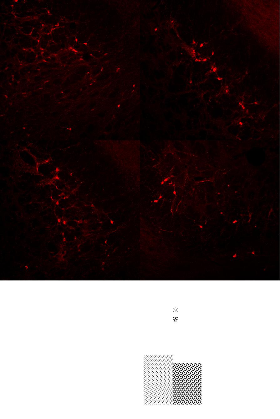 Lee et al. BMC Neurology (2016) 16:6 Page 5 of 9 A B C D A B No. of ChAT+ cells/slice E Leison 40 30 * * * 20 10 C 0 Fig. 2 Representative photographs showing ChAT-immunopositive neurons in the NBM.