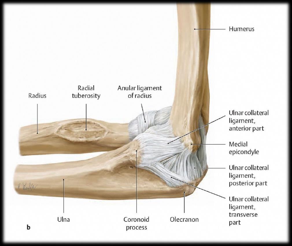Elbow: ulnar collateral ligament (UCL) Anterior fibers Overuse: microtrauma from