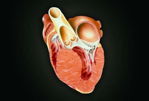 Cardiomyopathy Cardiomyopathy Cardiomyopathy is a disease involving changes in the heart muscle.