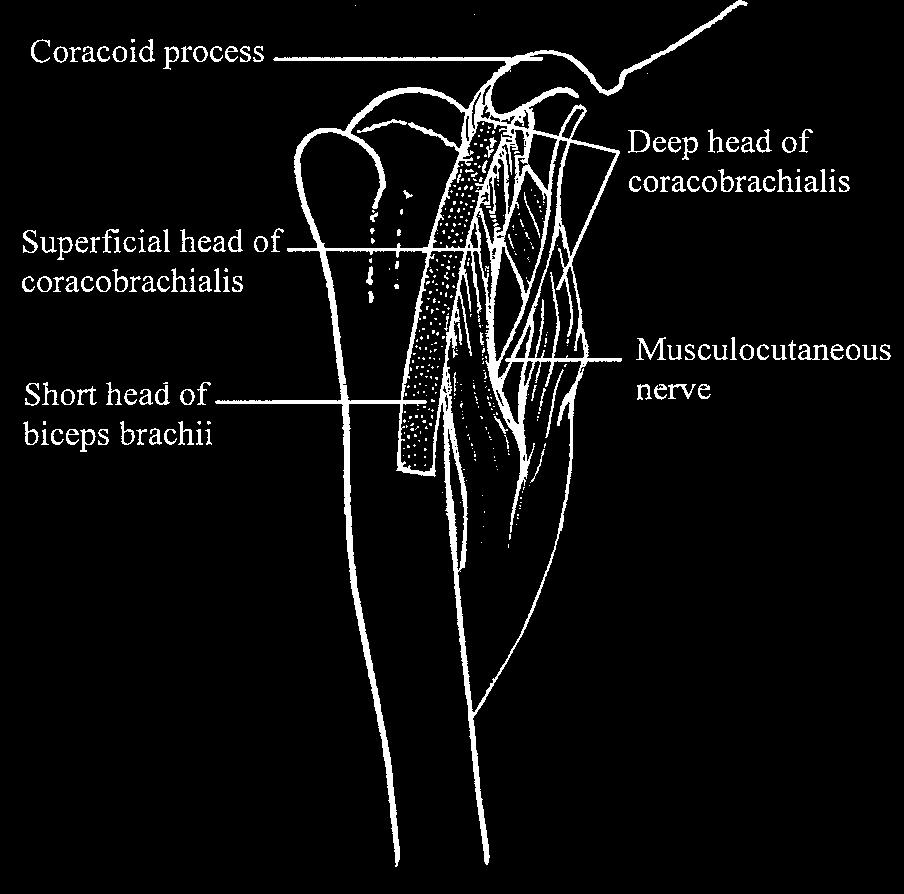 Mostafa M El-Naggar, Morphology of coracobrachialis Figure 2. A figure showing the origin of the superficial and deep heads of the coracobrachialis muscle.