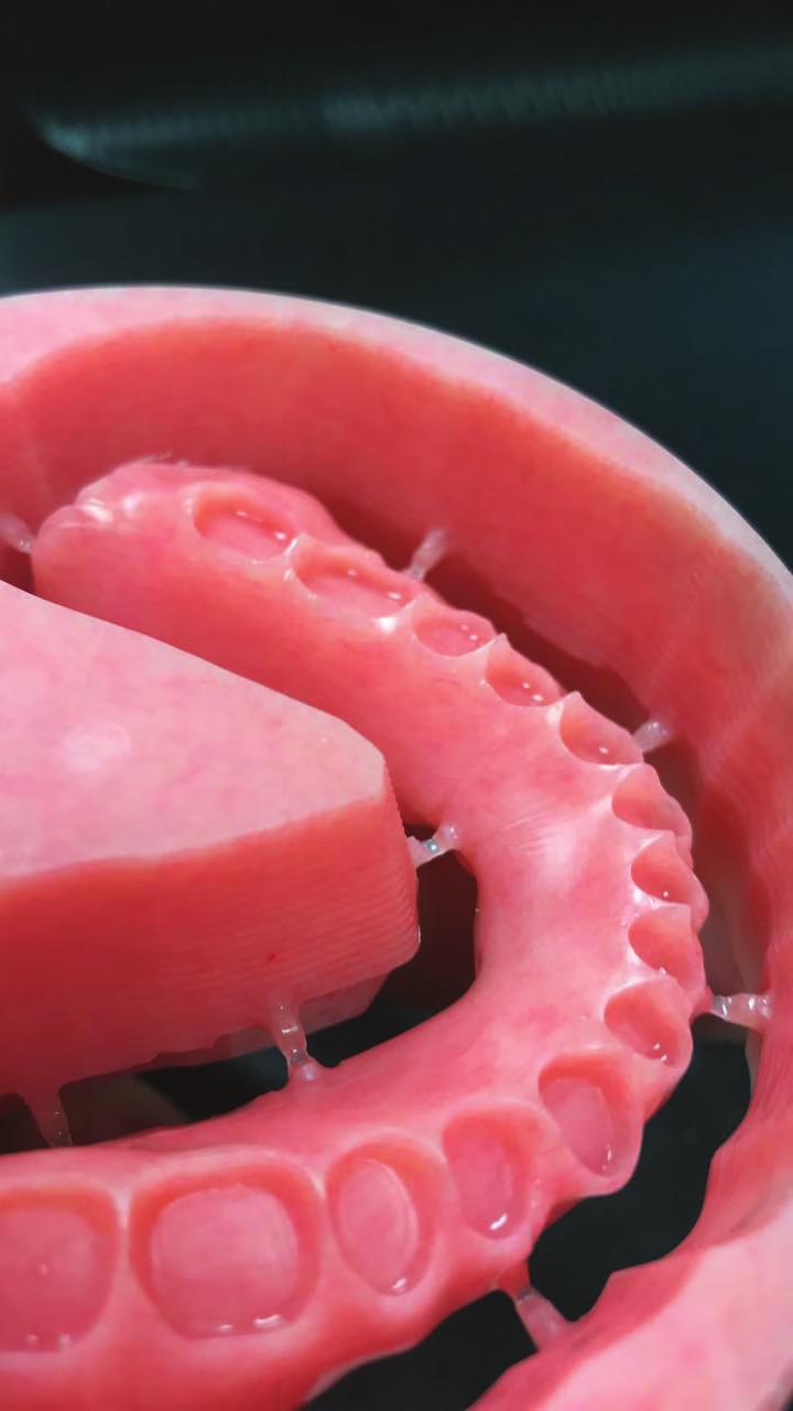 The digital process of designing and manufacturing the try-in and final denture is another step in the evolution of CAD/CAM dental solutions.