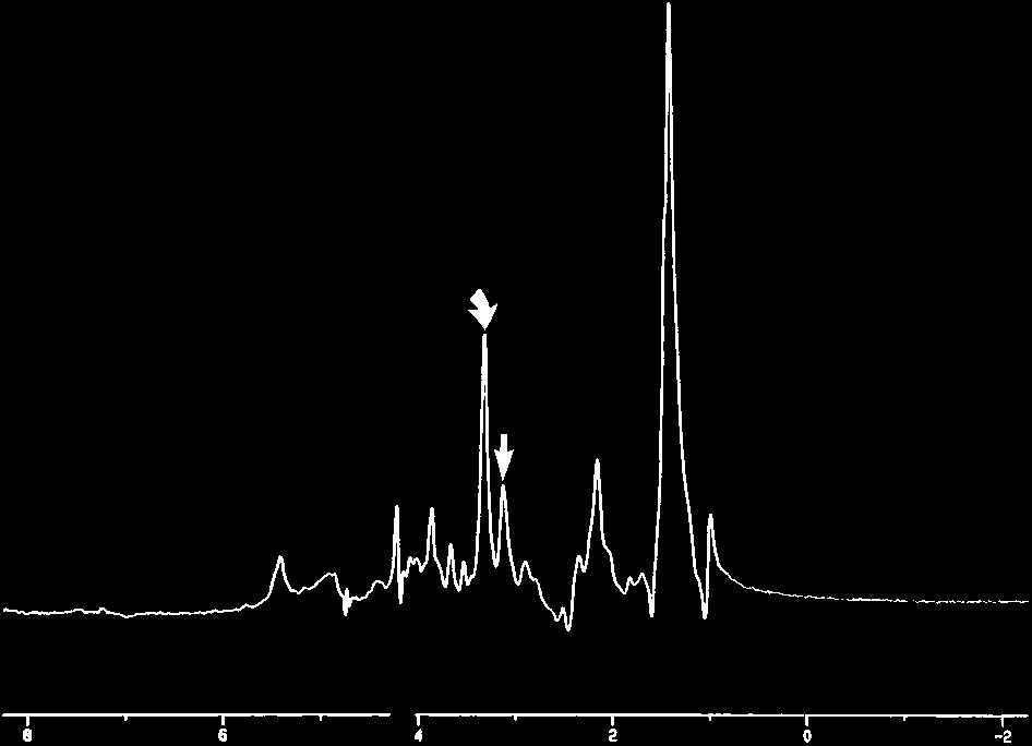 Curved arrow indicates Cho; straight arrow, Cr. FIG 3. Vagal schwannoma. In vitro 1D proton MR spectrum (2000/136/128) shows elevation of the Cho/Cr ratio.