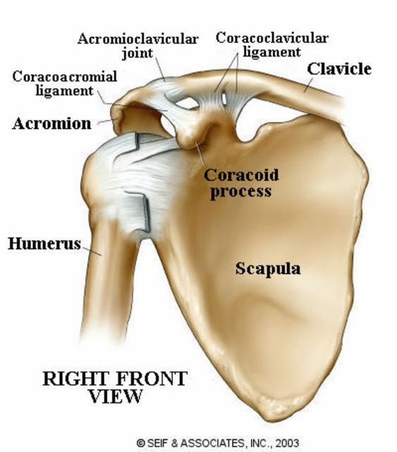 AC Separation or Strain Partial or full tear of the acromioclavicular ligament Direct fall to