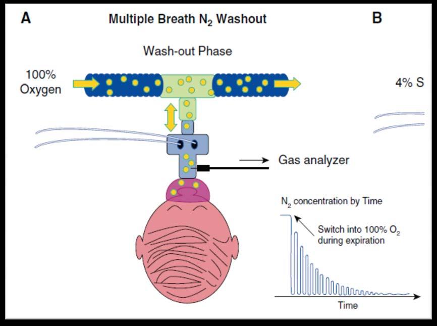 Multiple Breath Washout and Lung Clearance Index (LCI) LCI reflects the