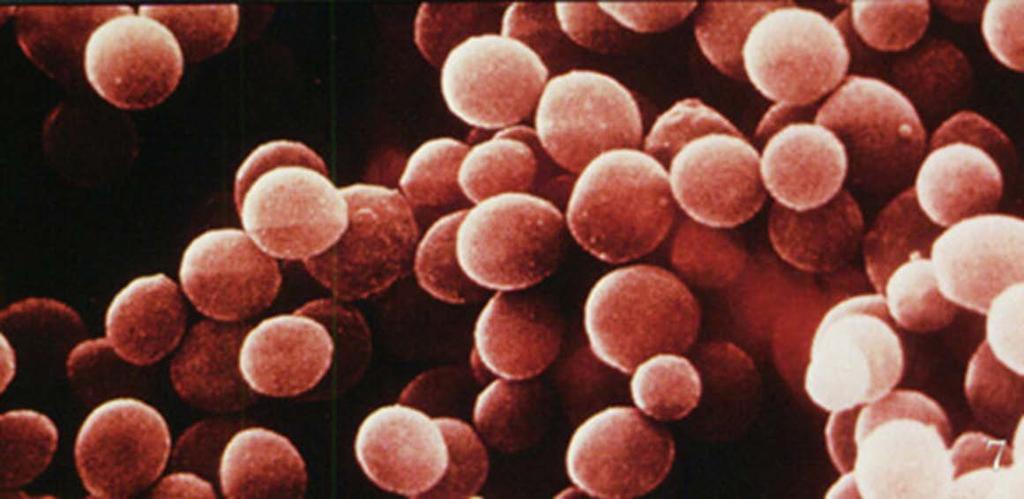 MRSA is a significant problem for some patients Can it be